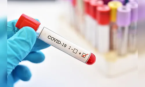 Jandaia do Sul registra 37 novos casos de Covid-19