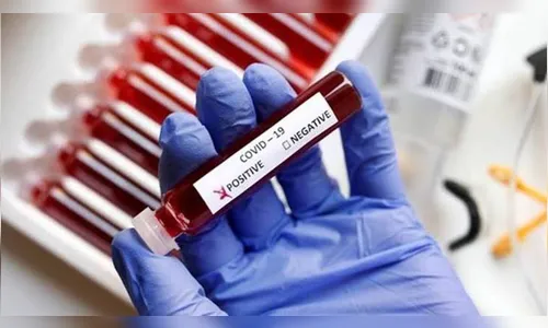 Londrina confirma 4 mortes e 272 novos casos de Covid