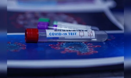 Londrina registra mais 302 casos de Covid-19 e 3 mortes