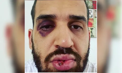 Médico do Paraná é agredido após defender lockdown