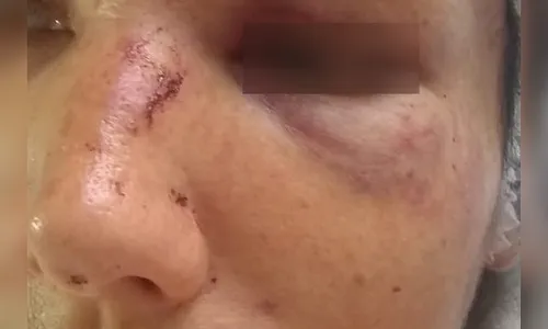 Mulher é agredida e ameaçada com canivete pelo companheiro