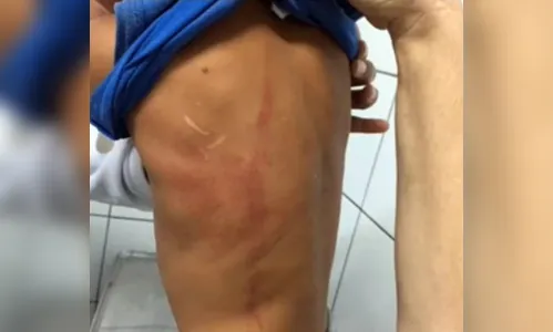 Mulher é presa suspeita de torturar filho de 3 anos