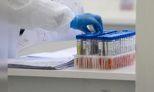 Paraná confirma primeira reinfecção pelo coronavírus