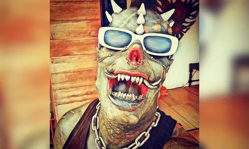 Após procedimento cirúrgico, Diabão recebe alta hospitalar