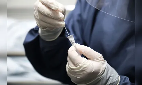 Apucarana registra mais um caso da variante indiana