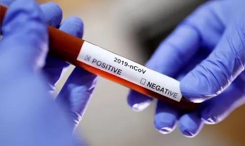 Arapongas registra 65 novos casos de Covid-19 e 02 óbitos