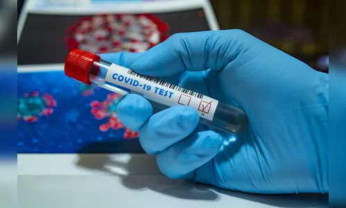 Arapongas registra 94 novos casos de Covid e 2 óbitos