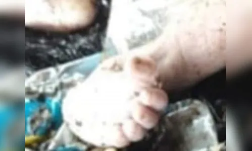 Bebê é encontrado num saco dentro de lixeira na região