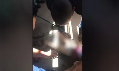 Criança de 1 ano morre após cair em fossa no quintal