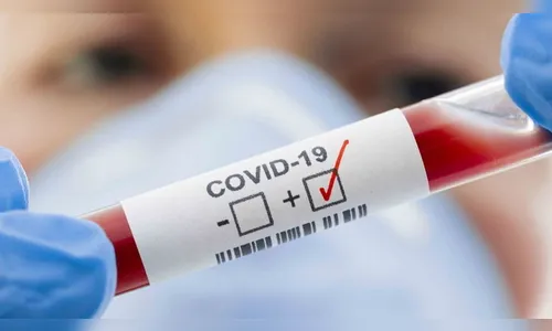 Dois vereadores e um servidor testam positivo para covid