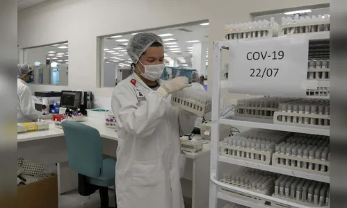 Ivaiporã soma mais 12 casos positivos de Covid neste domingo