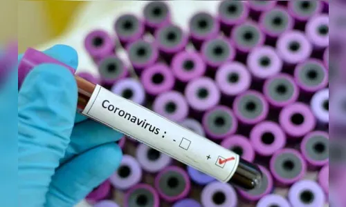 Ivaiporã tem mais 15 diagnósticos positivos de coronavírus