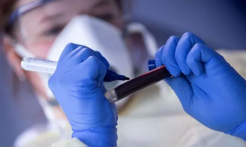 Mais 13 novos casos de Covid-19 são confirmados em Ivaiporã