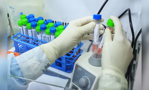 Nono caso da variante Delta é confirmado no Paraná