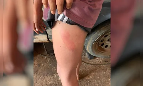 Por ser homossexual, adolescente sofre agressões do pai