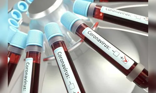 Mais 17 casos de Covid-19 confirmados em Ivaiporã