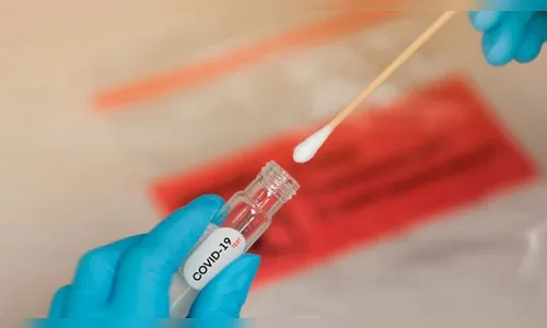Apucarana registra mais 20 casos de Covid-19