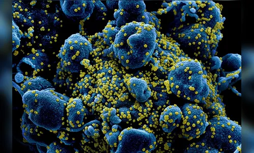 Apucarana registra uma morte e 16 novos casos de Covid