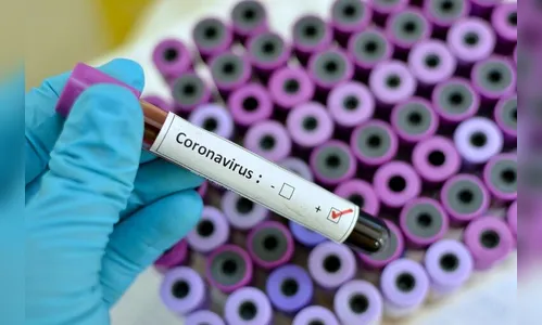 Apucarana tem mais um óbito e 18 casos de covid no sábado