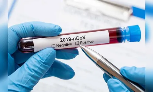 Arapongas registra 15 novos casos de Covid e nenhum óbito