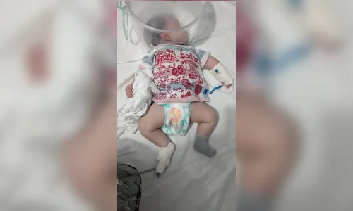 Bebê de 2 meses tem 90% do pulmão comprometido pela Covid-19