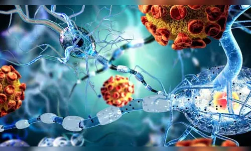 Covid pode acelerar sintomas parecidos com o Alzheimer