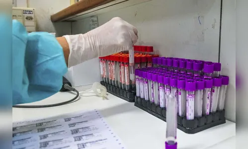 Ivaiporã registra 14 casos de Covid e 2 óbitos em uma semana