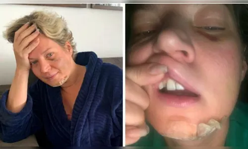 Joice Hasselmann presta depoimento sobre agressão