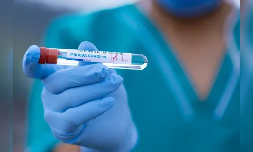 Mais 13 pessoas testam positivo para Covid-19 em Apucarana