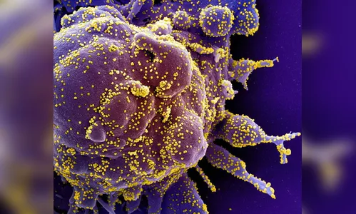 Mais 20 pessoas testam positivo para Covid-19 em Apucarana