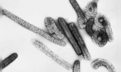 Marburg: Guiné registra 1ª morte por vírus raro e contagioso