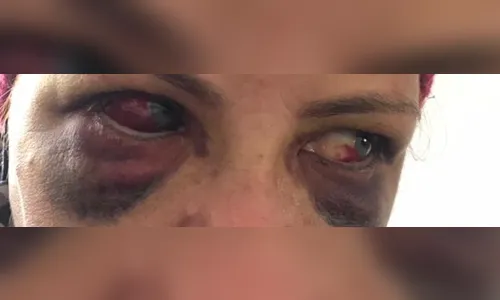 Marido que espancou esposa é preso em Arapongas