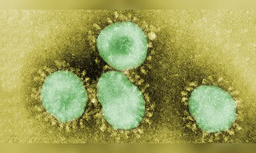 Maringá registra 63 novos casos de Covid e 2 mortes