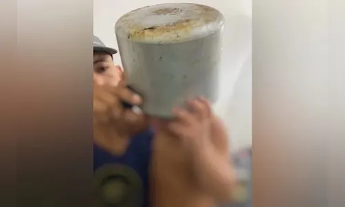 Menino de 2 anos prende cabeça em panela de pressão