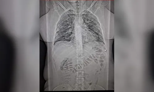 Jornalista e historiador de Maringá escreve sobre Covid