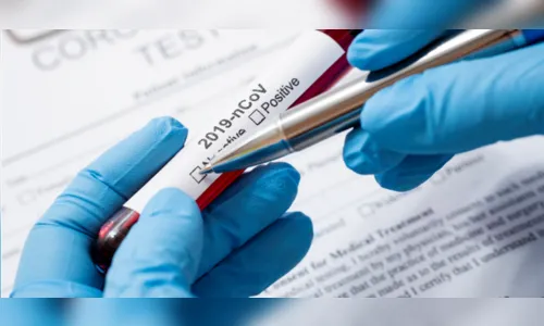 Paraná soma 37.998 óbitos e 1.476.662 casos por Covid-19