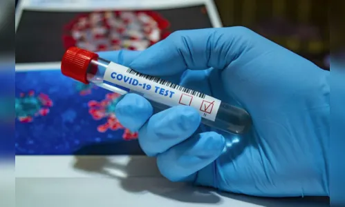 Paraná ultrapassa 36 mil mortes por Covid-19