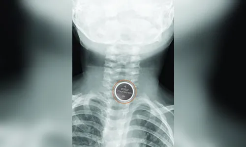 Preso morre asfixiado após ser obrigado a engolir sabonete