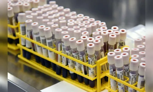 Saúde confirma 54 mortes por covid nesta sexta