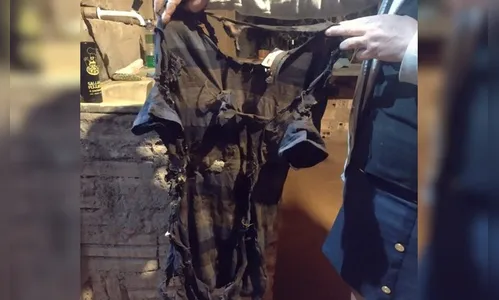 Sem gás, família se queima ao utilizar álcool para cozinhar