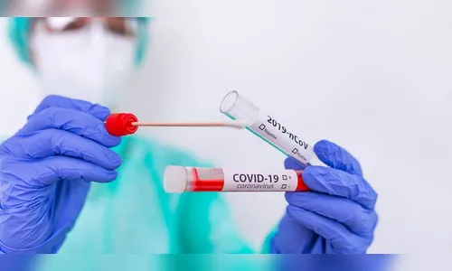 Sesa confirma mais 1.924 casos e 44 óbitos por Covid-19