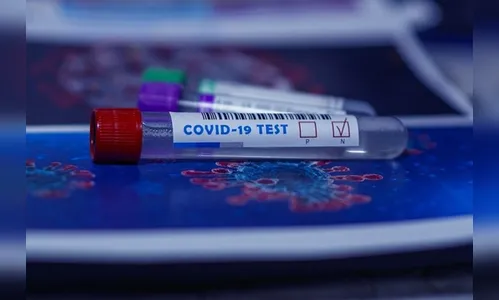 Sesa confirma mais 7.040 casos e 91 mortes por covid no PR