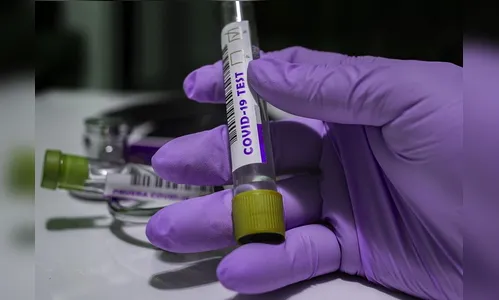 Sesa registra mais 1.543 novos casos e 40 óbitos pela Covid