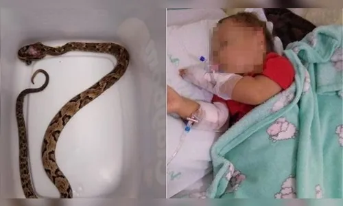 Susto: criança de 1 ano sobrevive a picada de cobra jararaca