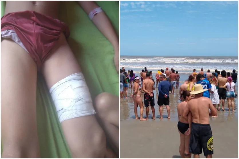 Criança de 11 anos é ferida por tubarão no litoral paulista