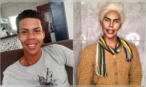 Adolescente desiste de se transformar em Ken Humano