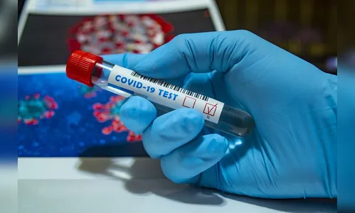 Apucarana confirma mais oito casos de Covid-19 neste sábado