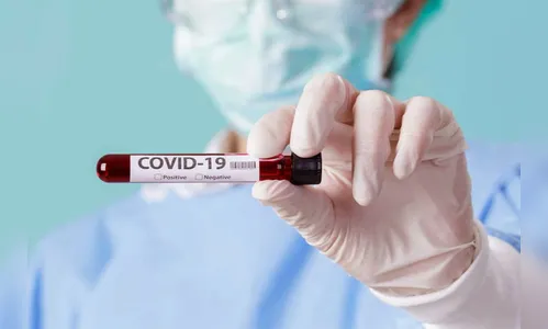 Arapongas confirma 84 novos casos da Covid neste sábado