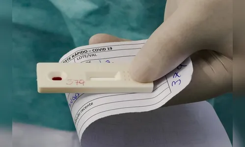 Arapongas registra 19 novos casos de Covid-19 e nenhum óbito