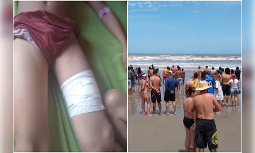 Criança de 11 anos é ferida por tubarão no litoral paulista